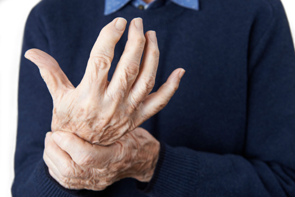 how to treat arthritis naturally